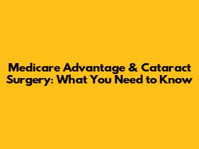 Medicare Advantage & Cataract Surgery: What You Need to Know